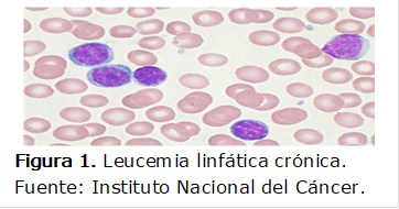  
Figura 1. Leucemia linfática crónica. 
Fuente: Instituto Nacional del Cáncer.