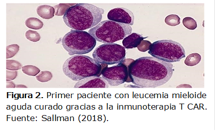  
Figura 2. Primer paciente con leucemia mieloide aguda curado gracias a la inmunoterapia T CAR. 
Fuente: Sallman (2018).